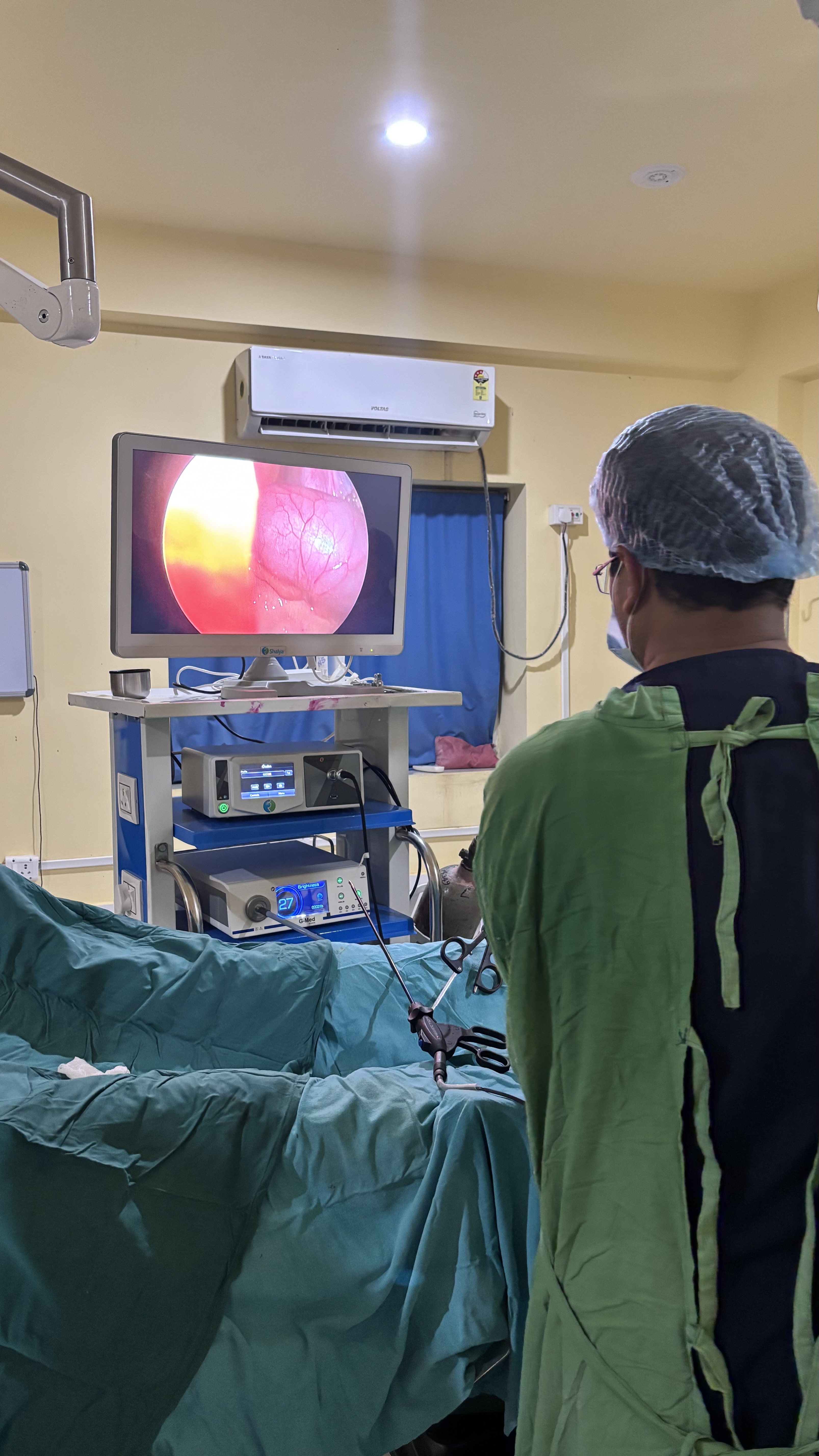 Laparoscopy Machine Demonstration 